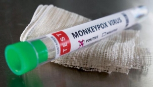 Türkiyede ilk maymun çiçeği vakası tespit edildi